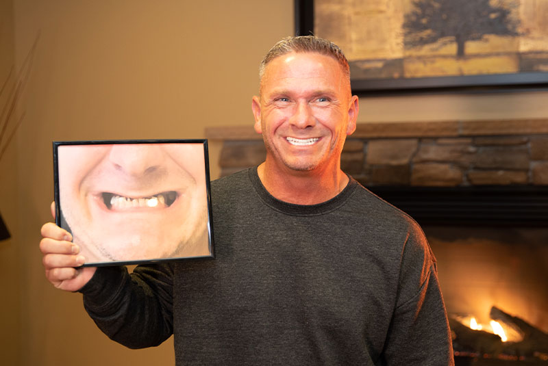 Shane – Full Mouth Reconstruction
